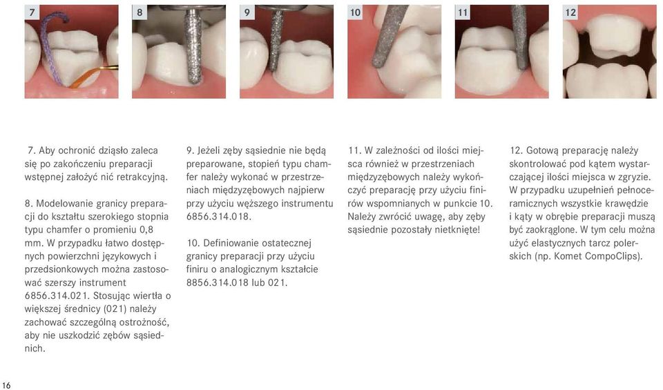 Stosując wiertła o większej średnicy (021) należy zachować szczególną ostrożność, aby nie uszkodzić zębów sąsiednich. 9.