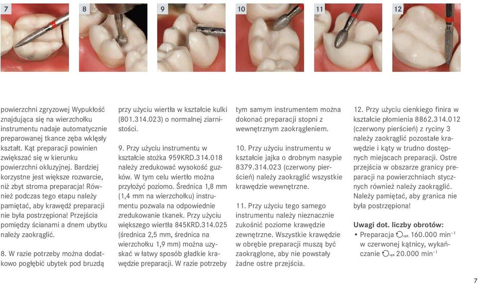 Również podczas tego etapu należy pamiętać, aby krawędź preparacji nie była postrzępiona! Przejścia pomiędzy ścianami a dnem ubytku należy zaokrąglić. 8.