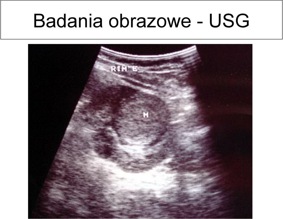 - USG