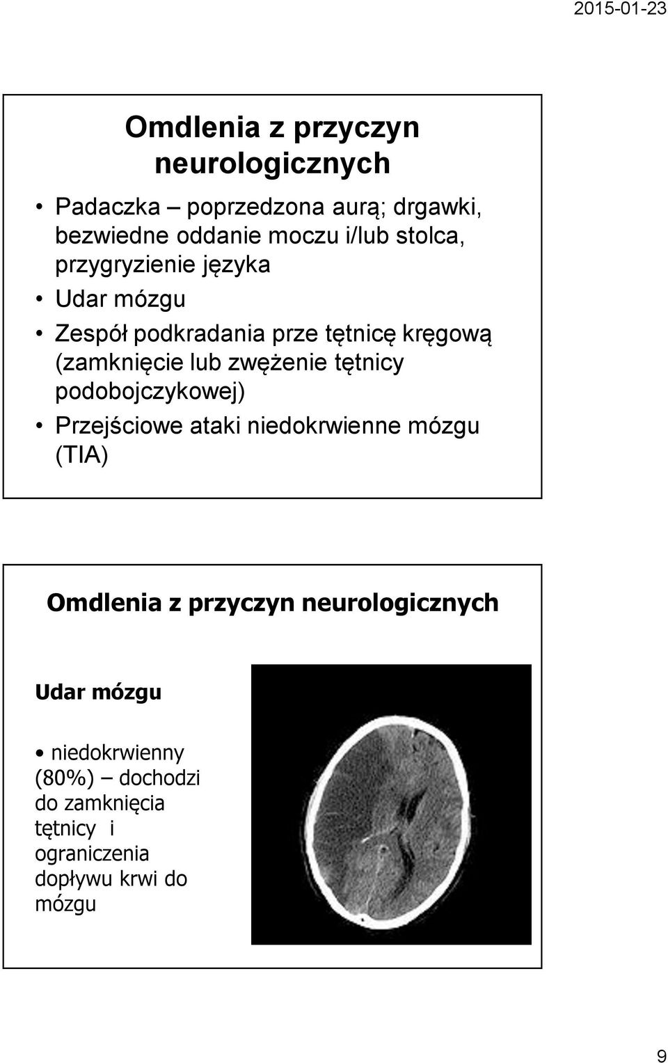zwężenie tętnicy podobojczykowej) Przejściowe ataki niedokrwienne mózgu (TIA) Omdlenia z przyczyn