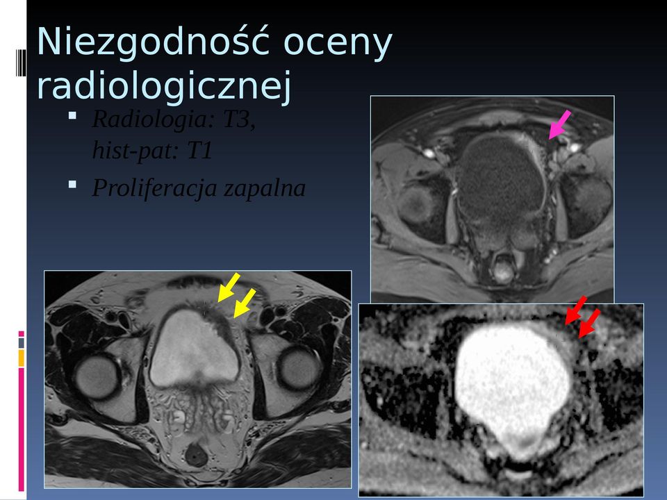 Radiologia: T3,