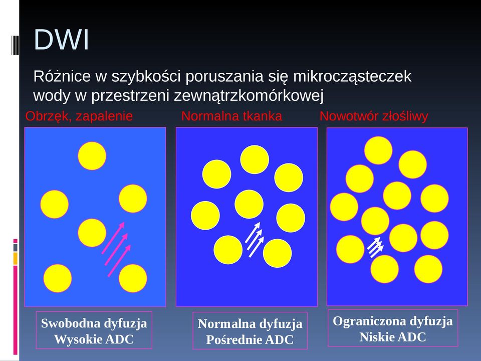 Swobodna dyfuzja Wysokie ADC Normalna tkanka Normalna