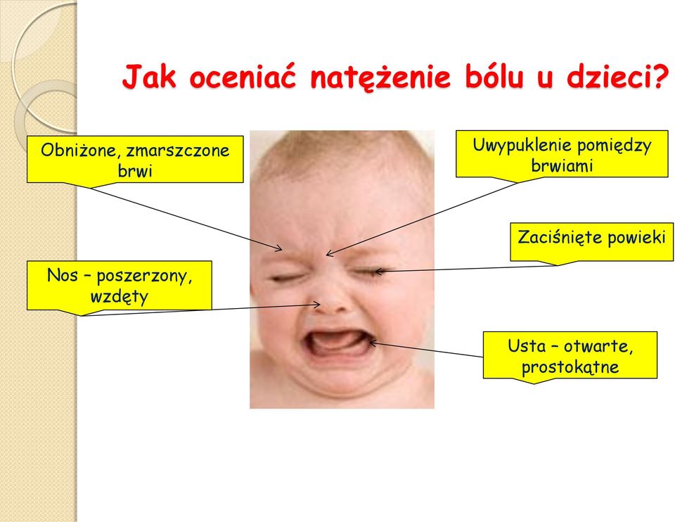 pomiędzy brwiami Zaciśnięte powieki Nos