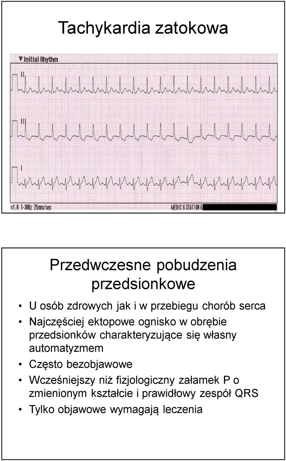 charakteryzujące się własny automatyzmem Często bezobjawowe Wcześniejszy niż