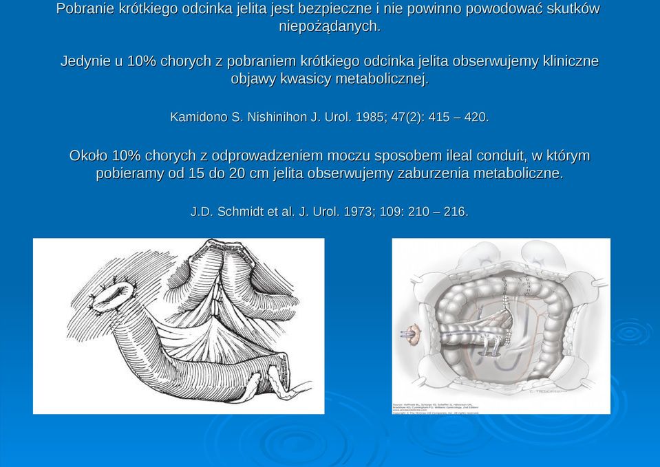 Kamidono S. Nishinihon J. Urol. 1985; 47(2): 415 420.