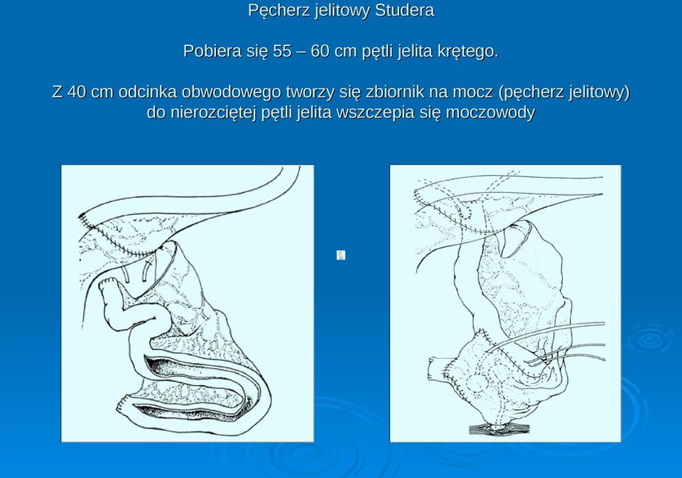 Z 40 cm odcinka obwodowego tworzy się zbiornik