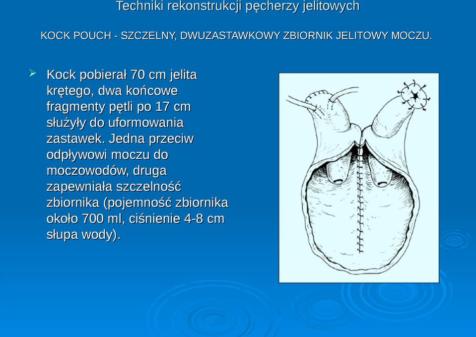 Kock pobierał 70 cm jelita krętego, dwa końcowe fragmenty pętli po 17 cm służyły do