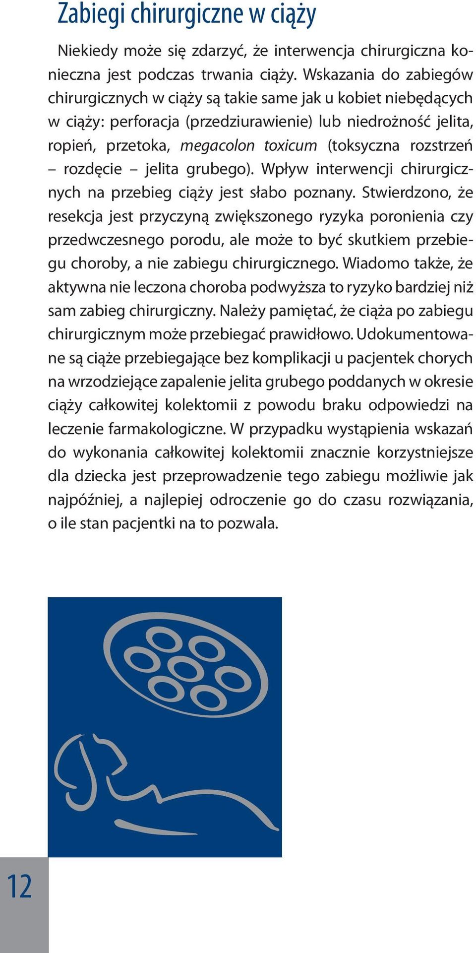 rozstrzeń rozdęcie jelita grubego). Wpływ interwencji chirurgicznych na przebieg ciąży jest słabo poznany.