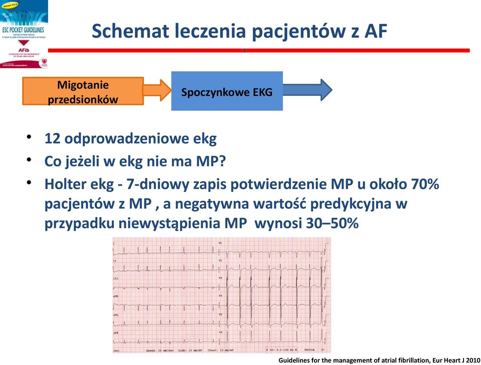 Holter ekg - 7-dniowy zapis potwierdzenie MP u około 70% pacjentów z MP, a negatywna