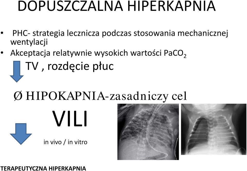 wysokich wartości PaCO 2 TV, rozdęcie płuc Ø