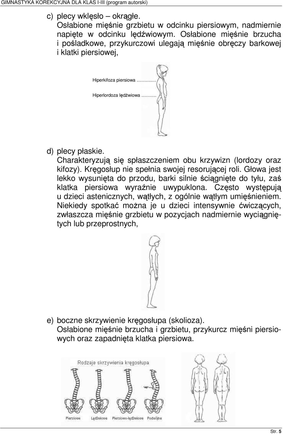 Charakteryzują się spłaszczeniem obu krzywizn (lordozy oraz kifozy). Kręgosłup nie spełnia swojej resorującej roli.