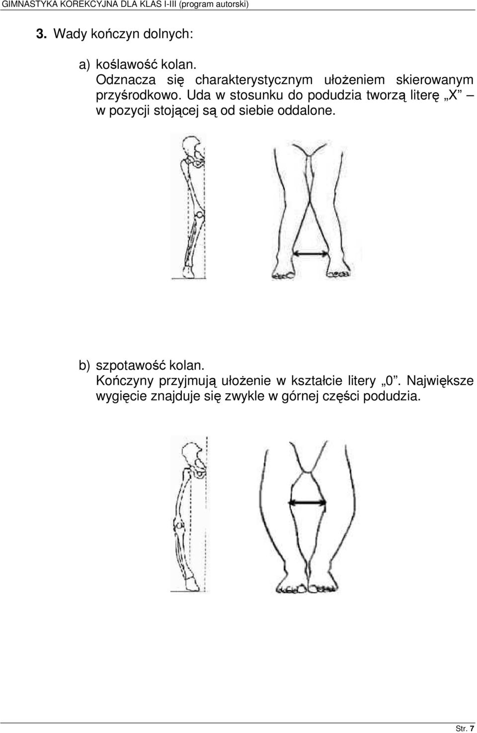 Uda w stosunku do podudzia tworzą literę X w pozycji stojącej są od siebie oddalone.