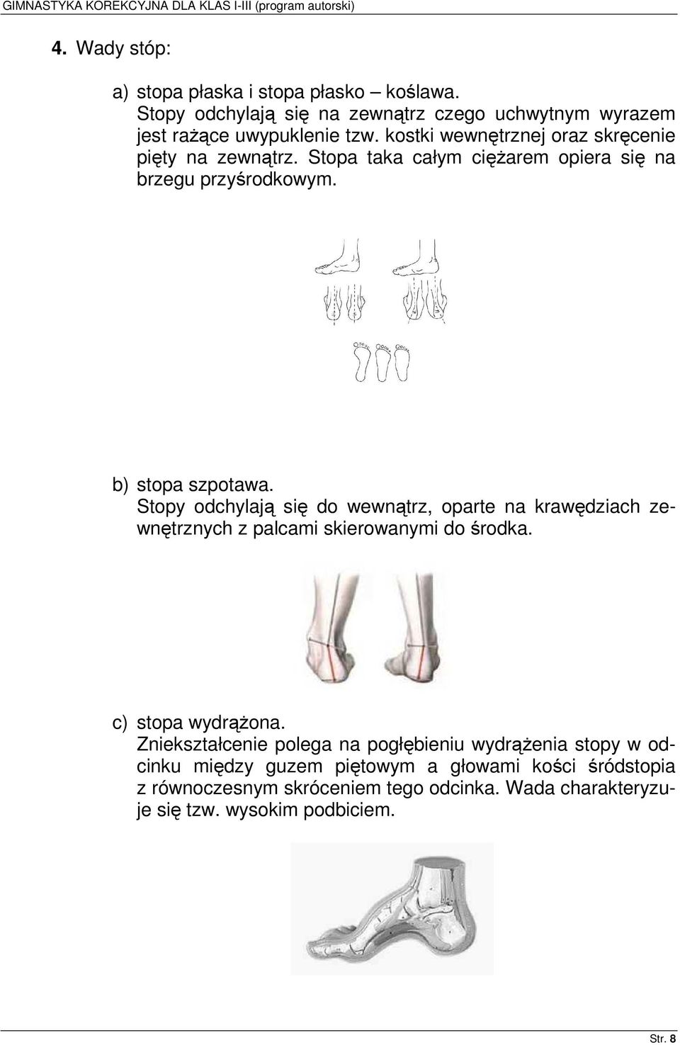 Stopy odchylają się do wewnątrz, oparte na krawędziach zewnętrznych z palcami skierowanymi do środka. c) stopa wydrążona.