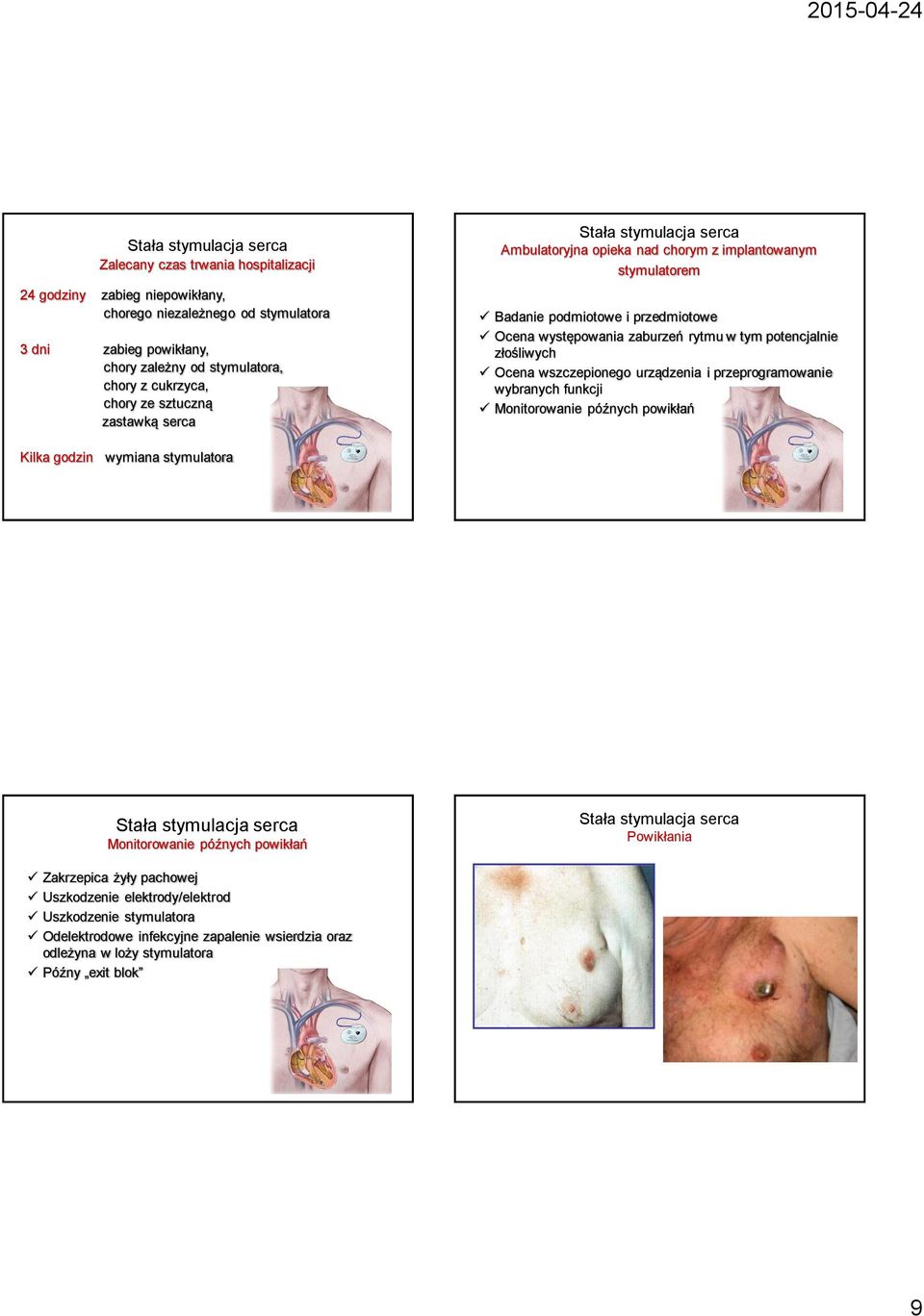potencjalnie złośliwych Ocena wszczepionego urządzenia i przeprogramowanie wybranych funkcji Monitorowanie późnych powikłań Kilka godzin wymiana stymulatora Monitorowanie późnych