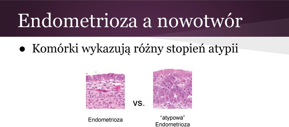 stopień atypii vs.