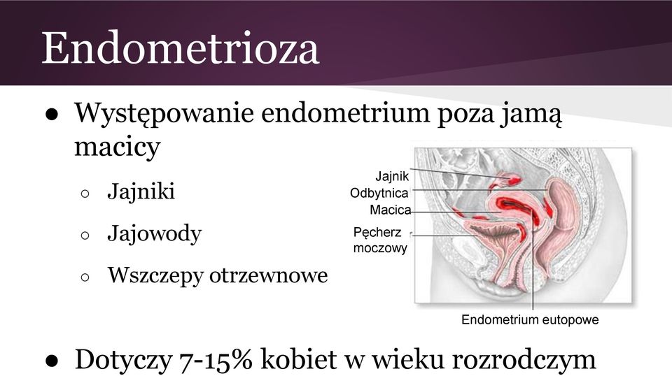 macicy Jajniki Jajowody Wszczepy otrzewnowe