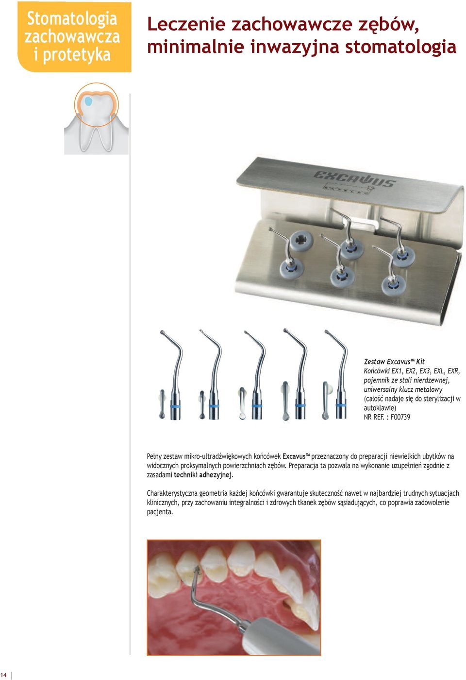 : F00739 Pełny zestaw mikro-ultradźwiękowych końcówek Excavus przeznaczony do preparacji niewielkich ubytków na widocznych proksymalnych powierzchniach zębów.