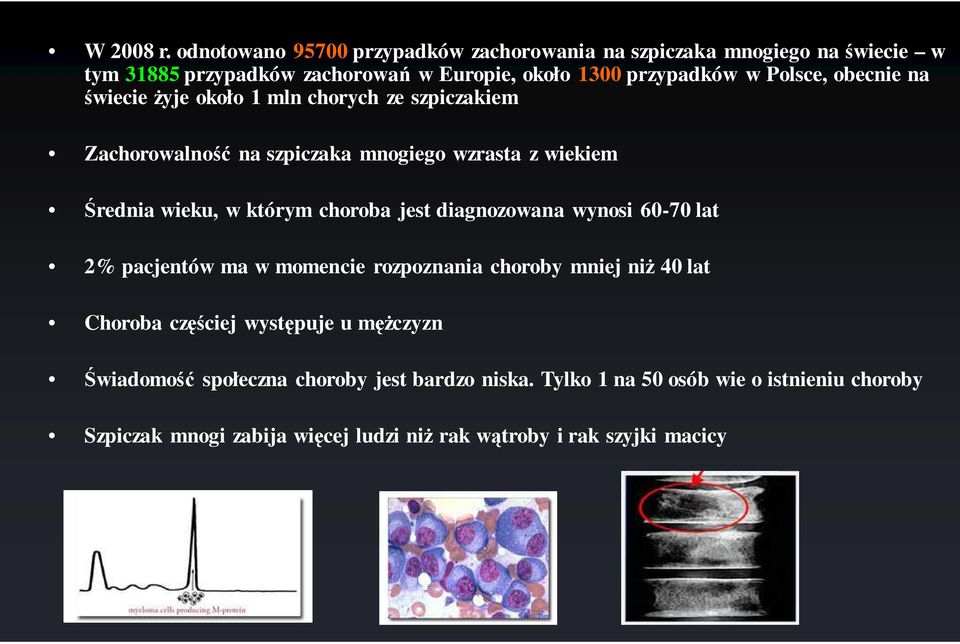 obecnie na świecie żyje około 1 mln chorych ze szpiczakiem Zachorowalność na szpiczaka mnogiego wzrasta z wiekiem Średnia wieku, w którym choroba jest