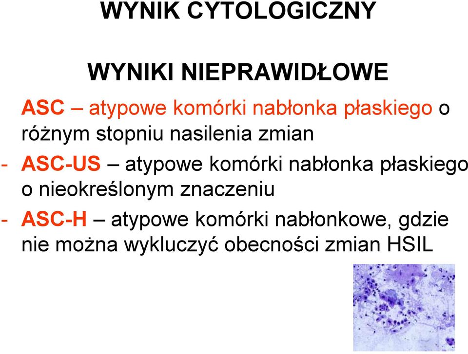 atypowe komórki nabłonka płaskiego o nieokreślonym znaczeniu -