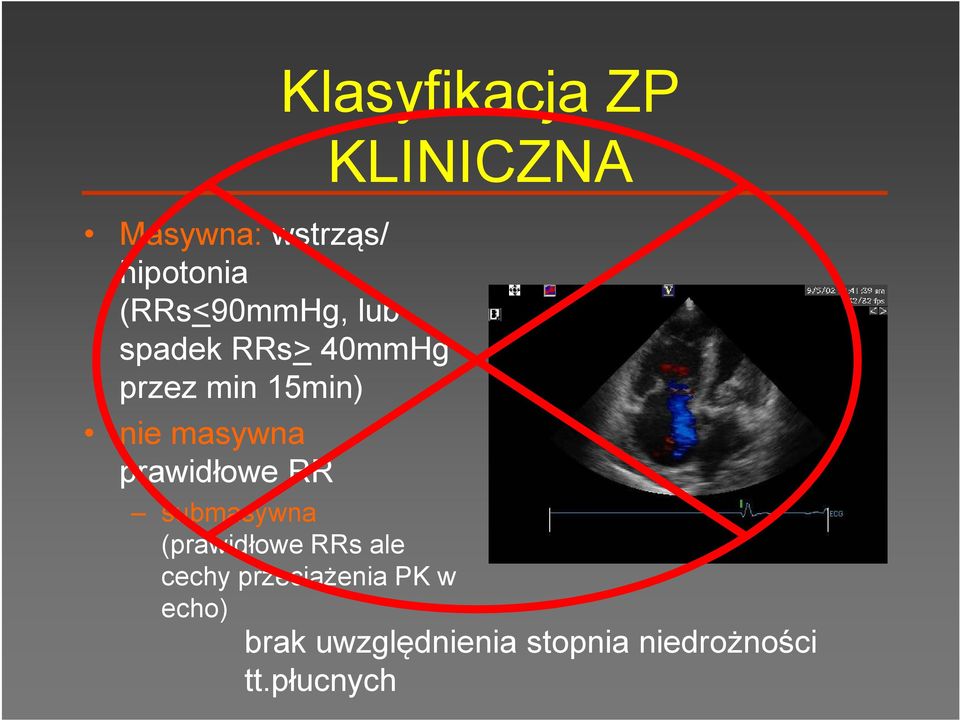 Klasyfikacja ZP KLINICZNA submasywna (prawidłowe RRs ale