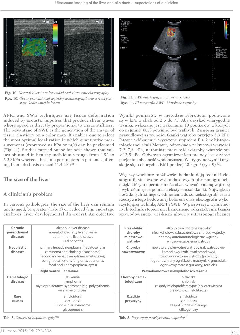 Marskość wątroby AFRI and SWE techniques use tissue deformation induced by acoustic impulses that produce shear waves whose speed is directly proportional to tissue stiffness.