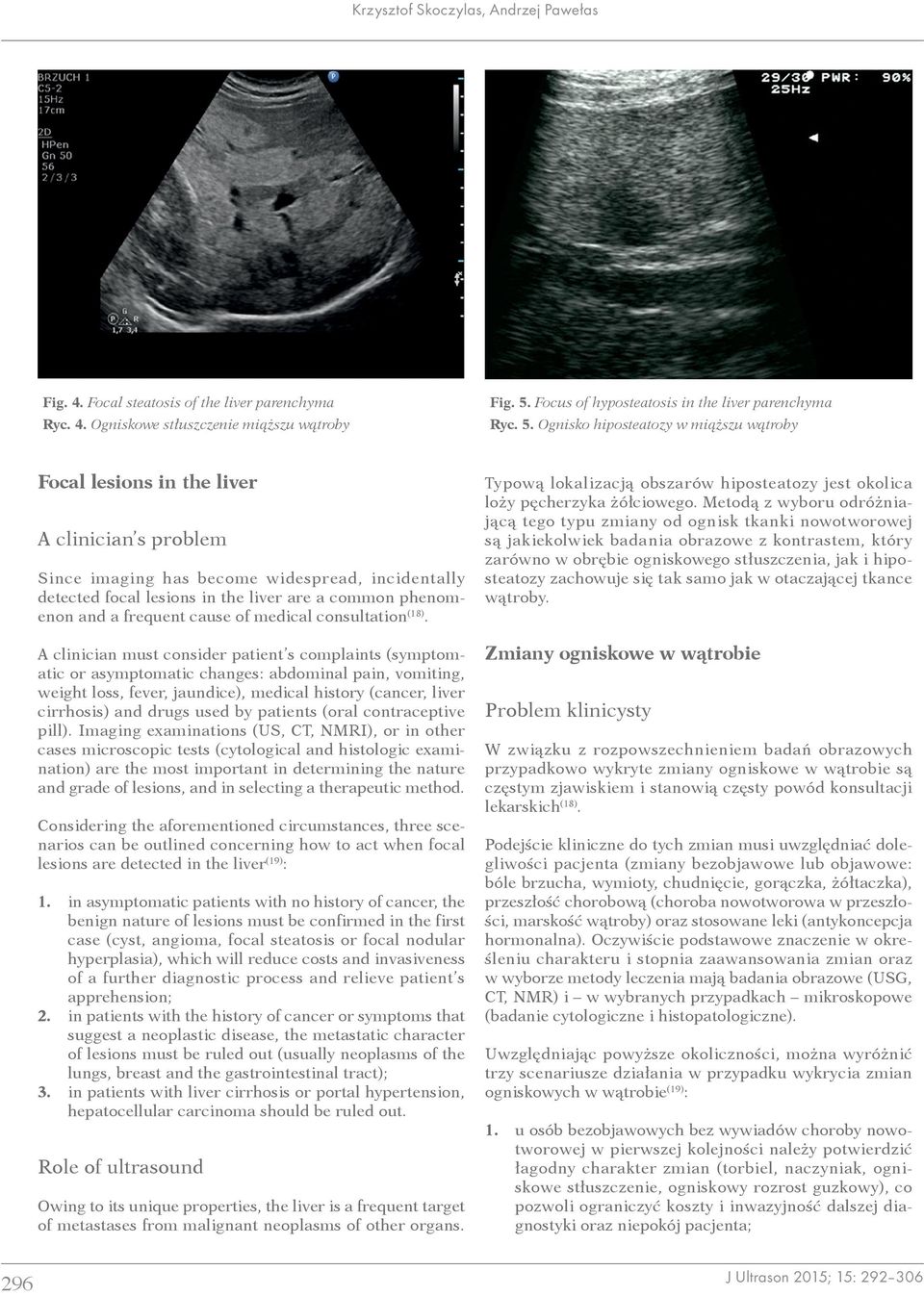 Ognisko hiposteatozy w miąższu wątroby Focal lesions in the liver A clinician s problem Since imaging has become widespread, incidentally detected focal lesions in the liver are a common phenomenon
