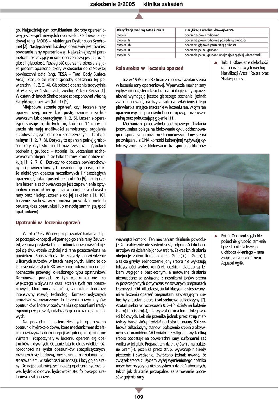Rozległość oparzenia określa się jako procent oparzonej skóry w stosunku do całkowitej powierzchni ciała (ang. TBSA Total Body Surface Area).