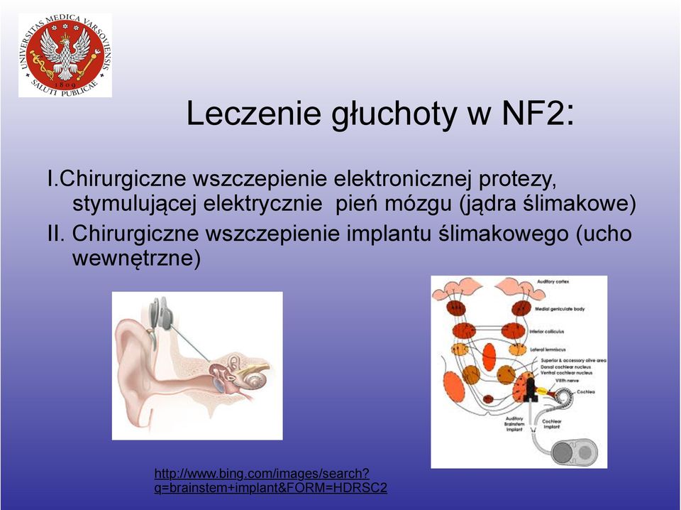 elektrycznie pień mózgu (jądra ślimakowe) II.