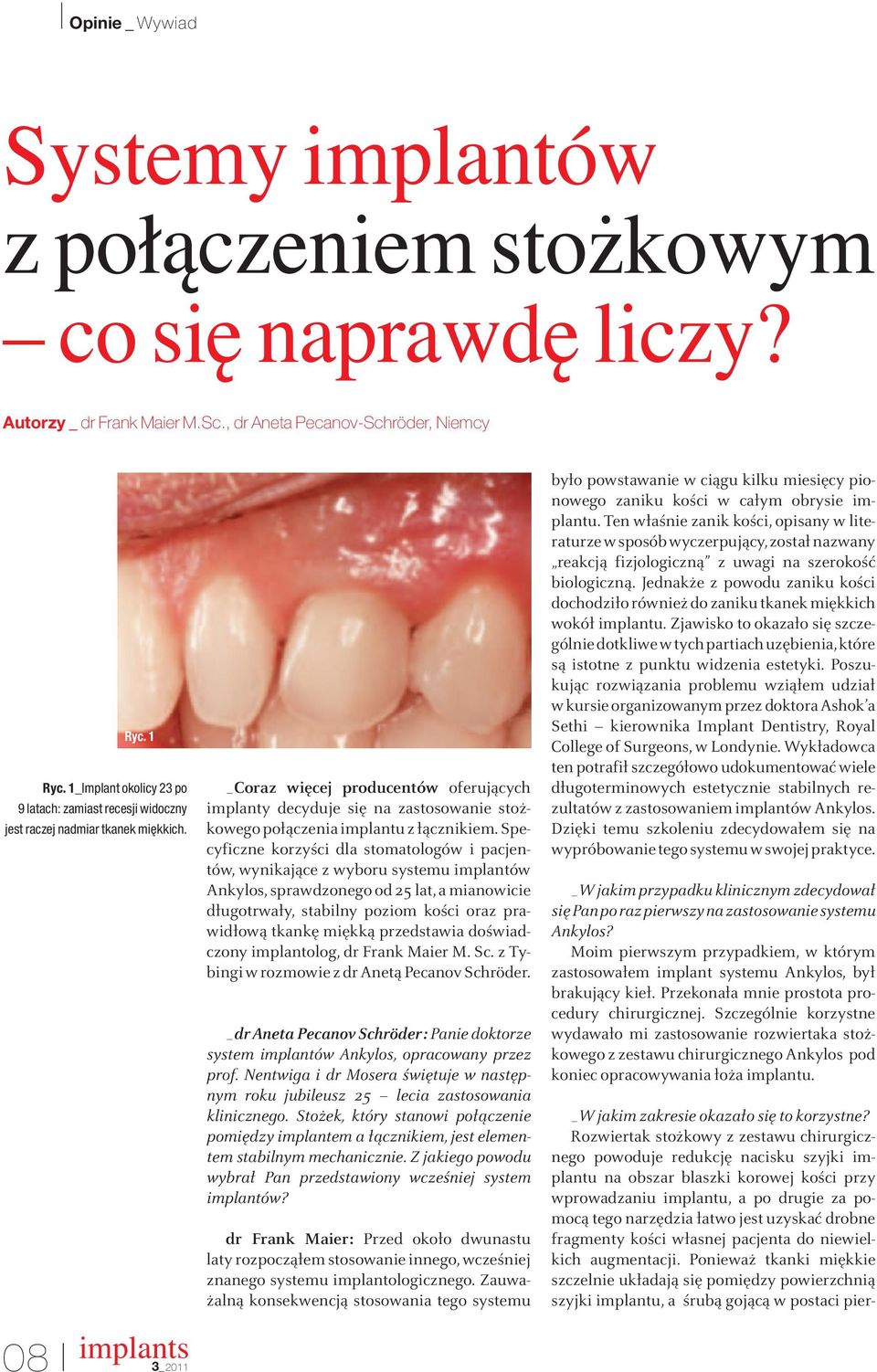 08 implants _Coraz więcej producentów oferujących implanty decyduje się na zastosowanie stoż - kowego połączenia implantu z łącznikiem.