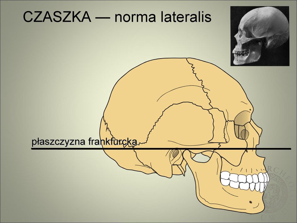 lateralis