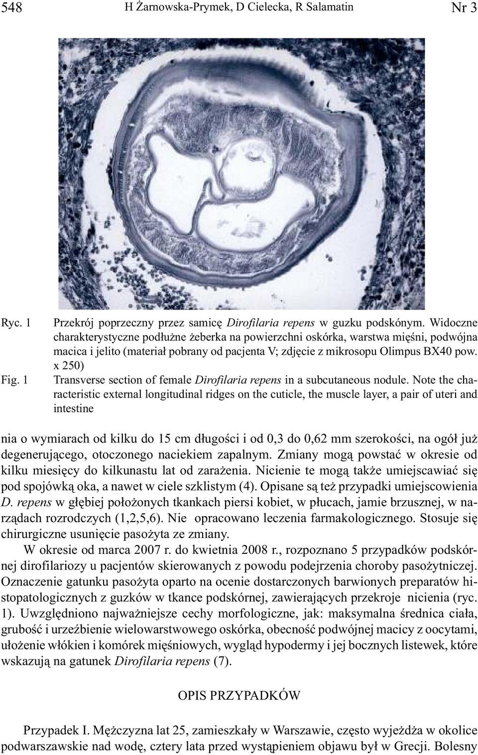 x 250) Transverse section of female Dirofilaria repens in a subcutaneous nodule.
