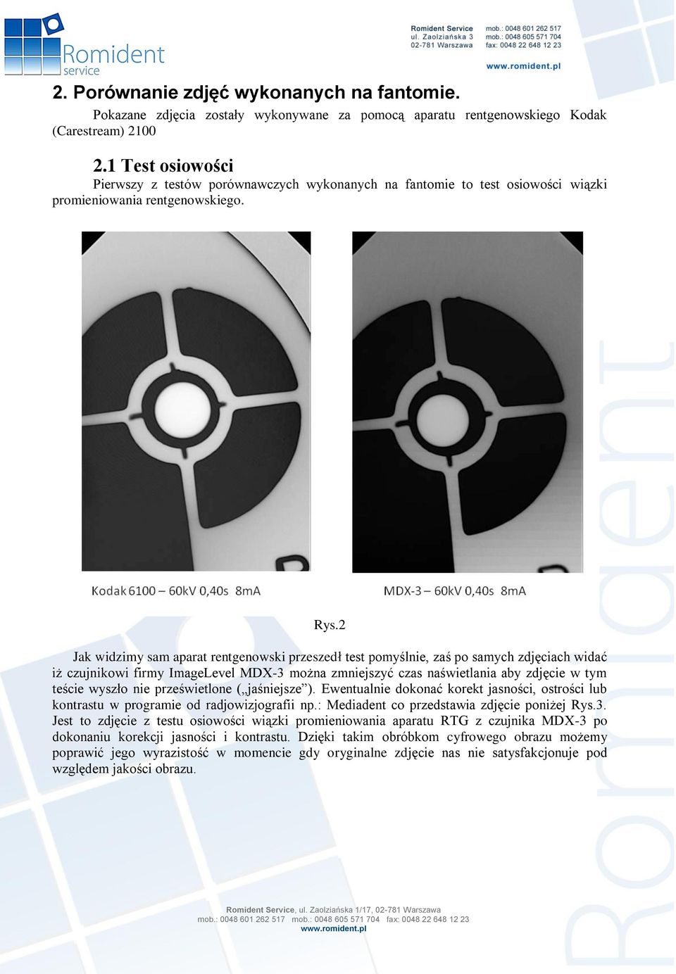 2 Jak widzimy sam aparat rentgenowski przeszedł test pomyślnie, zaś po samych zdjęciach widać iż czujnikowi firmy ImageLevel MDX-3 można zmniejszyć czas naświetlania aby zdjęcie w tym teście wyszło