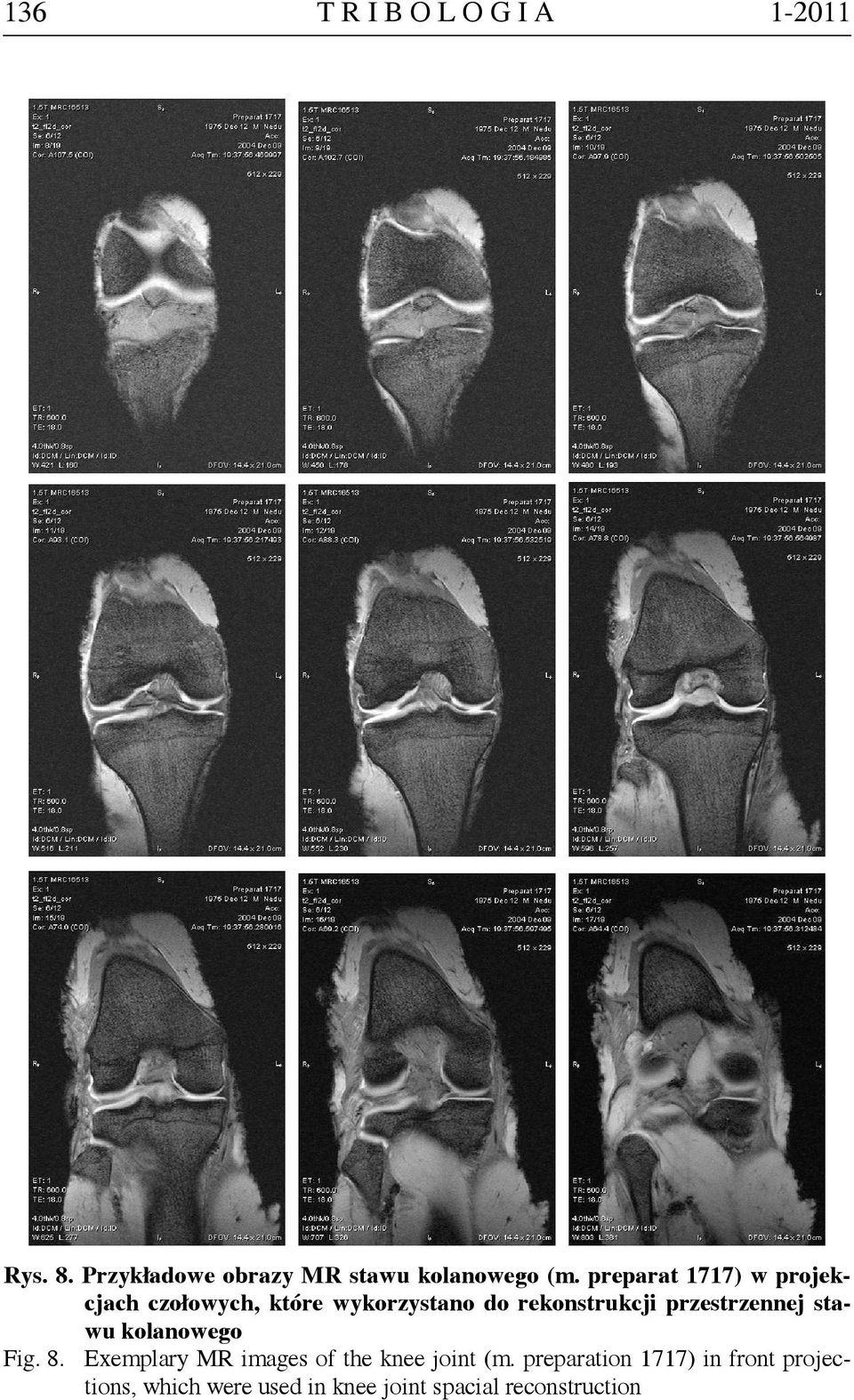 przestrzennej stawu kolanowego Fig. 8. Exemplary MR images of the knee joint (m.