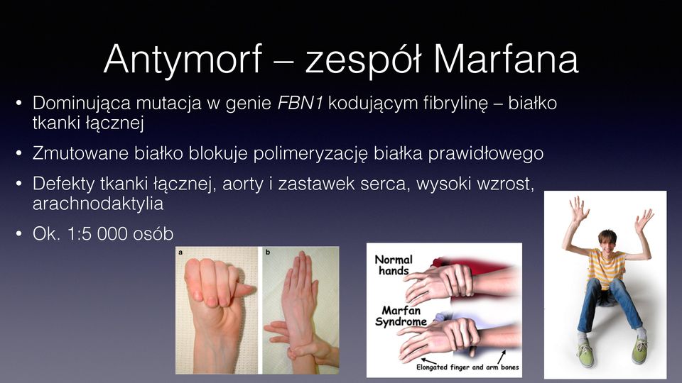 blokuje polimeryzację białka prawidłowego Defekty tkanki