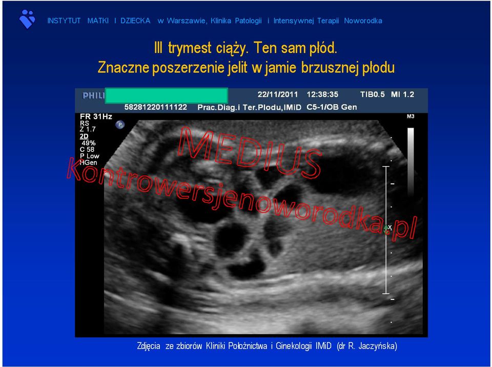 brzusznej płodu Zdjęcia ze zbiorów
