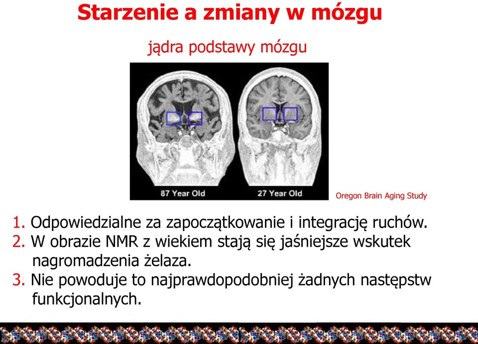 W obrazie NMR z wiekiem stają się jaśniejsze wskutek nagromadzenia