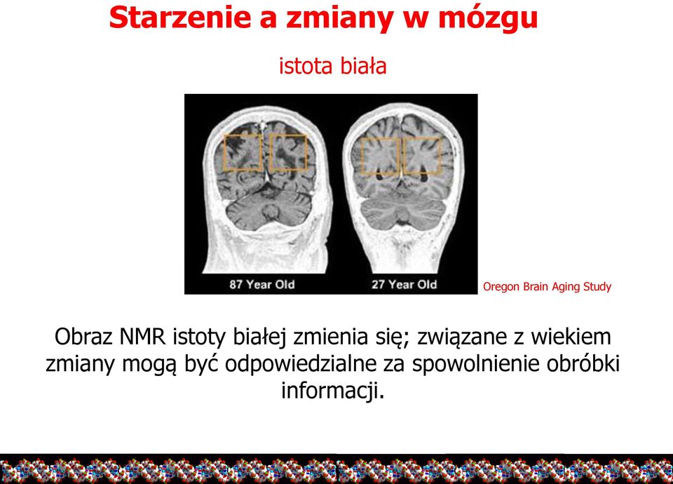 zmienia się; związane z wiekiem zmiany mogą