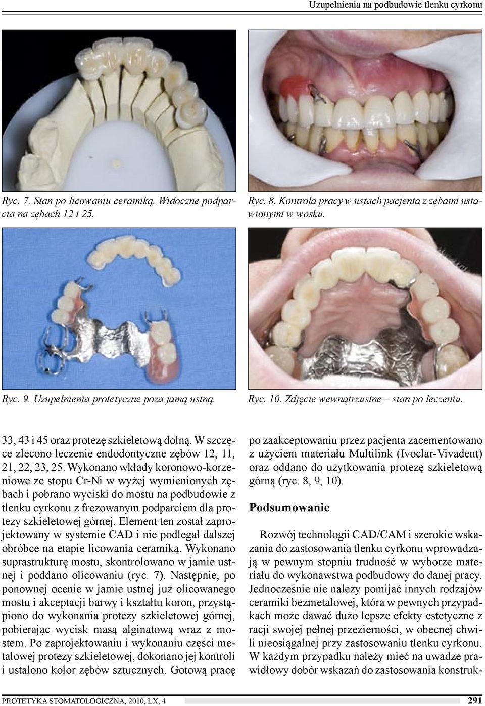 W szczęce zlecono leczenie endodontyczne zębów 12, 11, 21, 22, 23, 25.