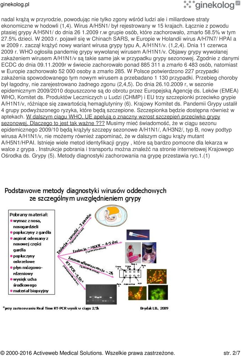 pojawił się w Chinach SARS, w Europie w Holandii wirus A/H7N7/ HPAI a w 2009 r. zaczął krążyć nowy wariant wirusa grypy typu A, A/H1N1/v. (1,2,4). Dnia 11 czerwca 2009 r.