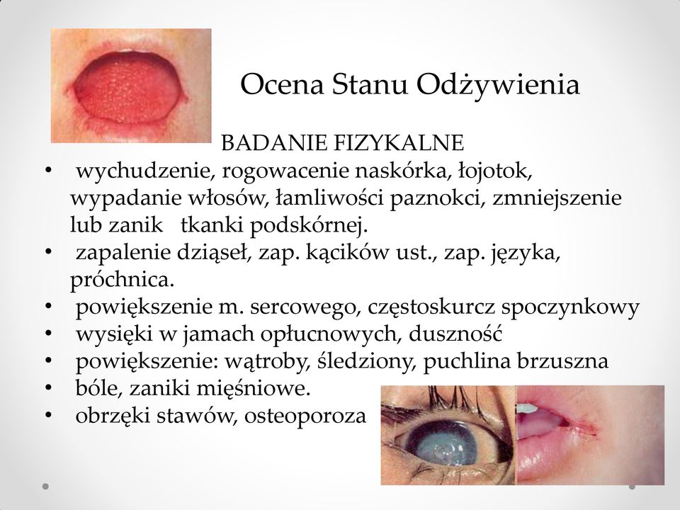 powiększenie m.
