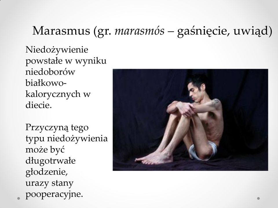 wyniku niedoborów białkowokalorycznych w diecie.