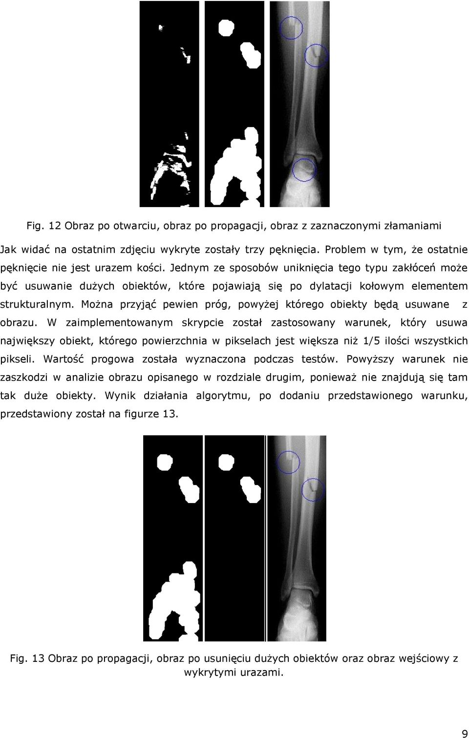 Jednym ze sposobów uniknięcia tego typu zakłóceń może być usuwanie dużych obiektów, które pojawiają się po dylatacji kołowym elementem strukturalnym.