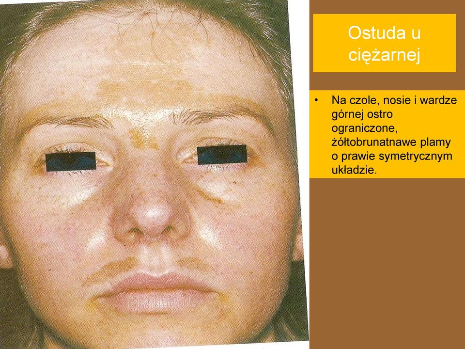 ograniczone, żółtobrunatnawe