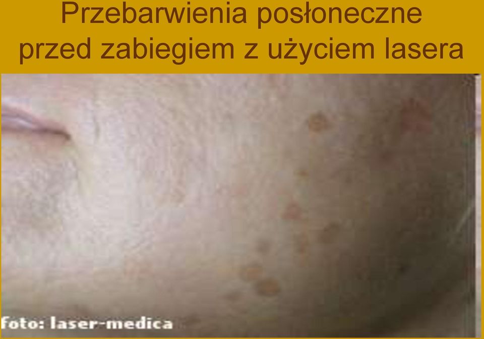 przed