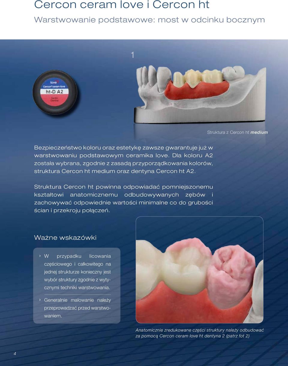 Struktura Cercon ht powinna odpowiadać pomniejszonemu kształtowi anatomicznemu odbudowywanych zębów i zachowywać odpowiednie wartości minimalne co do grubości ścian i przekroju połączeń.
