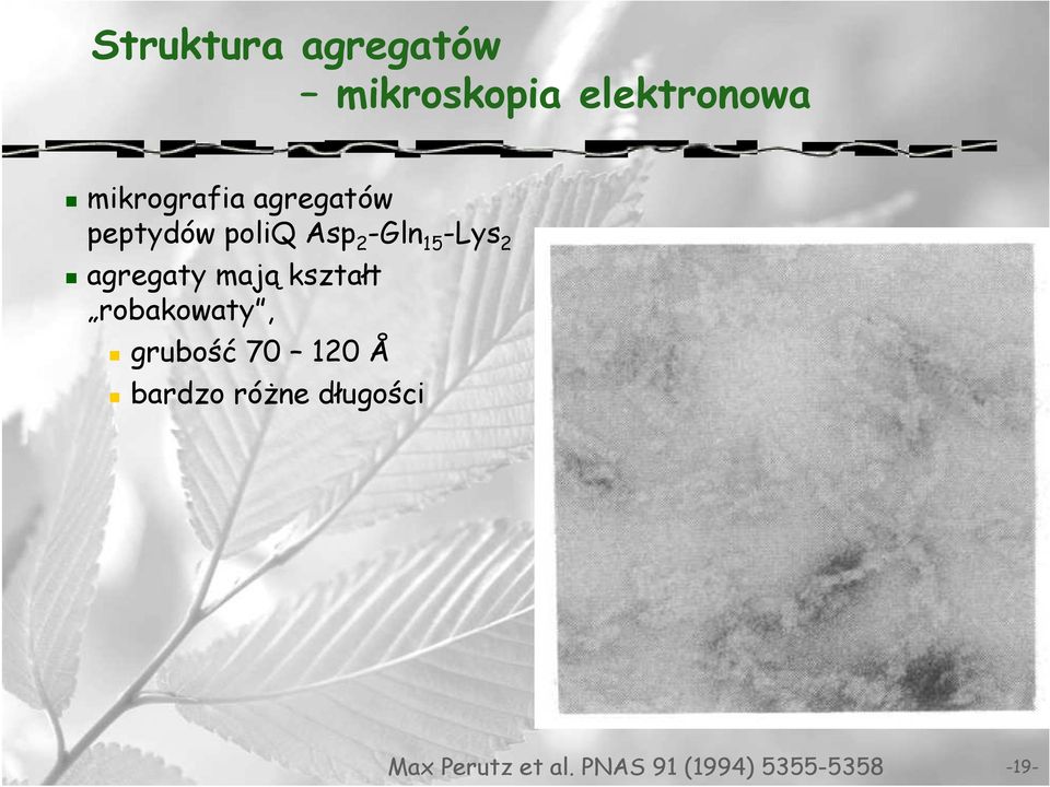mają kształt robakowaty, grubość 70 120 Å bardzo róŝne