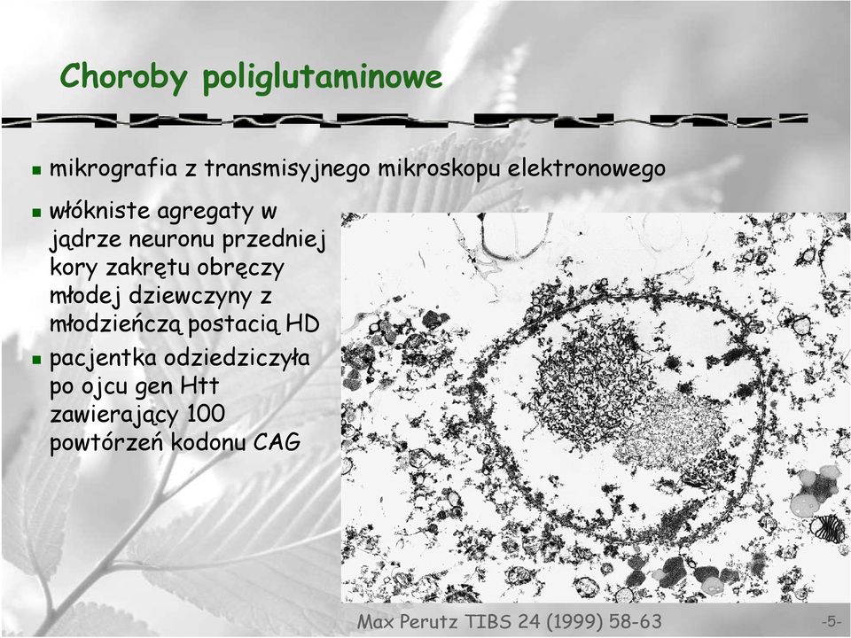 obręczy młodej dziewczyny z młodzieńczą postacią HD pacjentka odziedziczyła