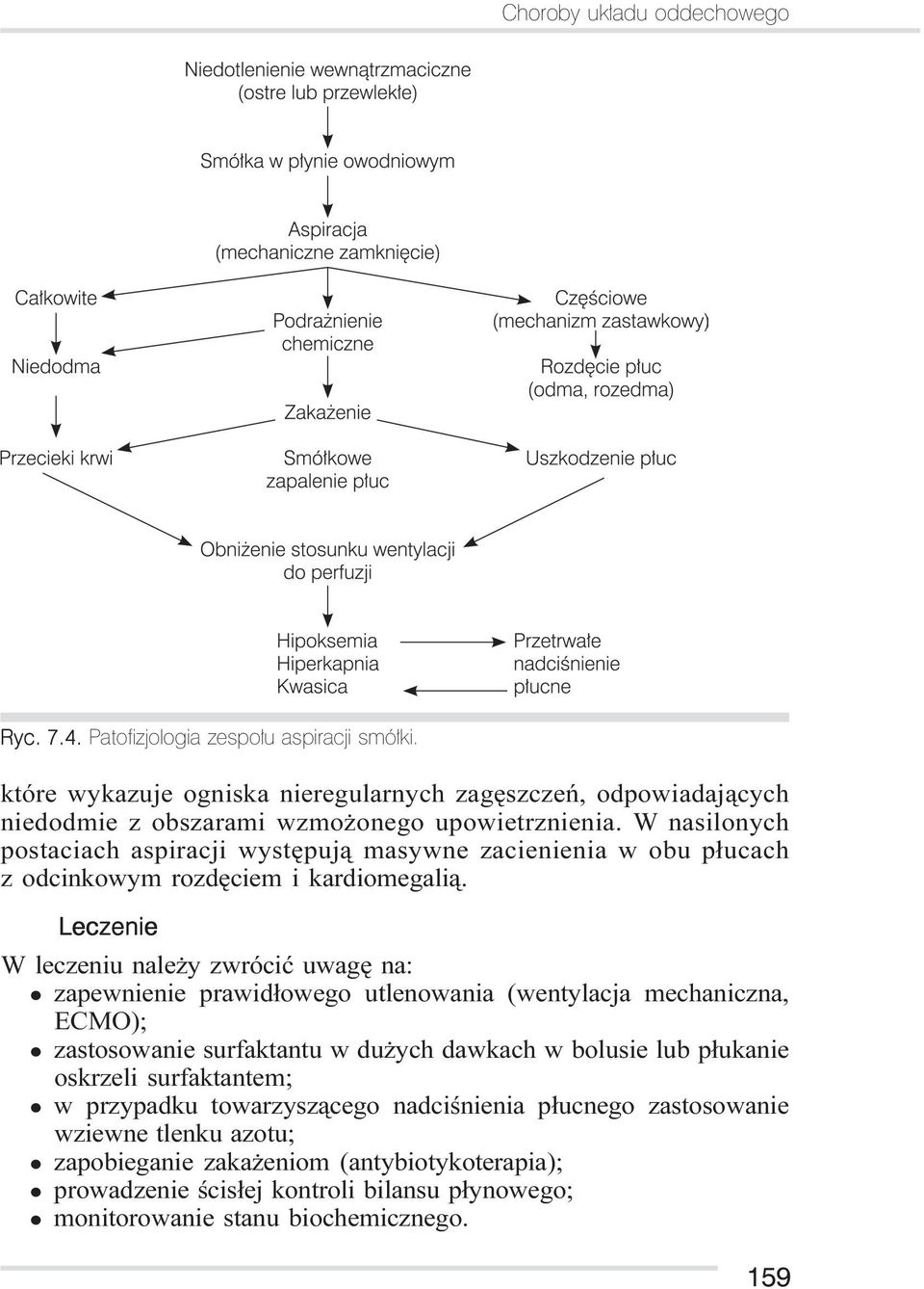 W nasilonych postaciach aspiracji wystêpuj¹ masywne zacienienia w obu p³ucach z odcinkowym rozdêciem i kardiomegali¹.