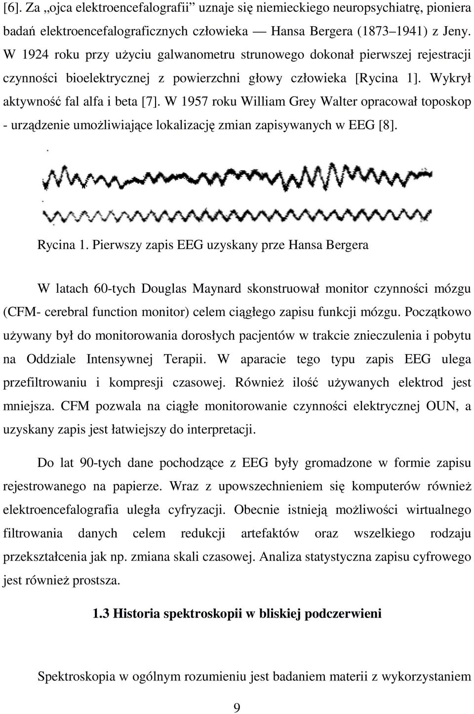 W 1957 roku William Grey Walter opracował toposkop - urządzenie umożliwiające lokalizację zmian zapisywanych w EEG [8]. Rycina 1.