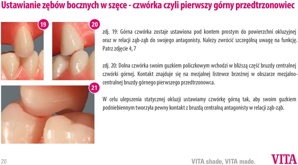 Patrz zdjęcie 4, 7 zdj. 20: Dolna czwórka swoim guzkiem policzkowym wchodzi w bliższą część bruzdy centralnej czwórki górnej.